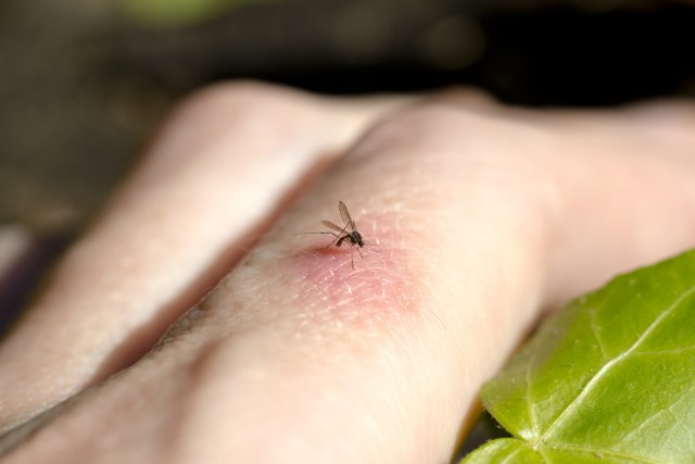 Protiv svraba od ujeda komarca: Jedna na namirnica je uvek spas