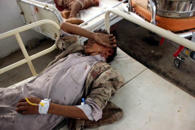 Užasni prizori iz Jemena: Gađan autobus s decom, 29 mrtvih