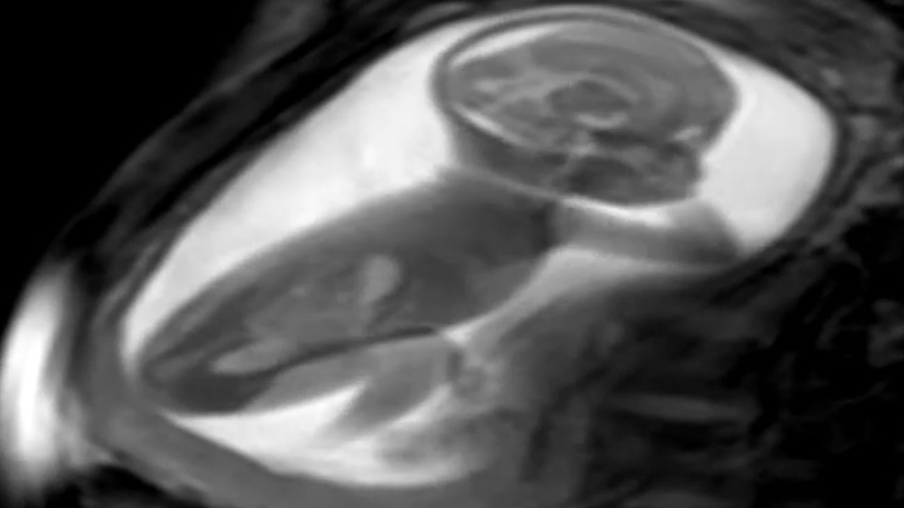 Istraživanje: Kako snimiti srce bebe u maminom stomaku