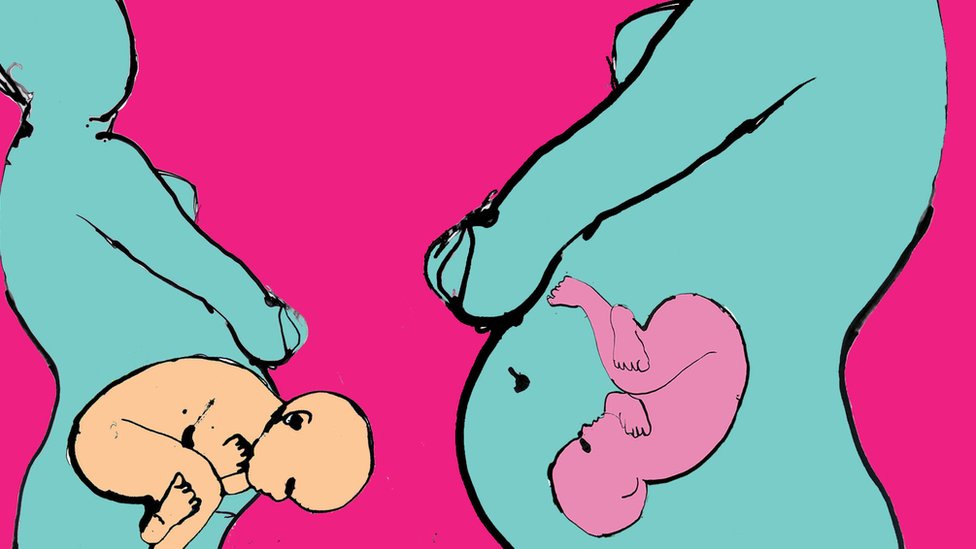 Carski rez ili prirodni poroðaj: Kako naèin roðenja utièe na zdravlje beba