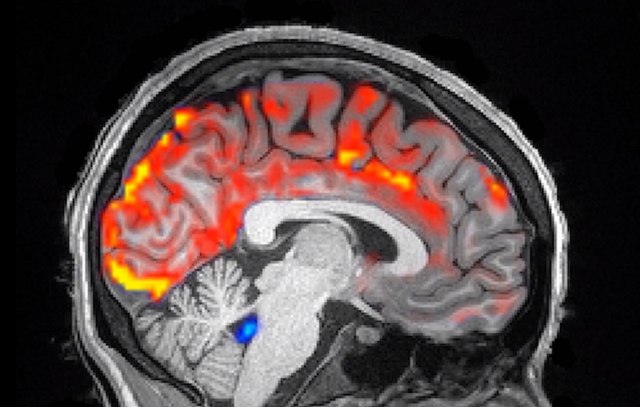 Kako izgleda pravo ispiranje mozga? VIDEO