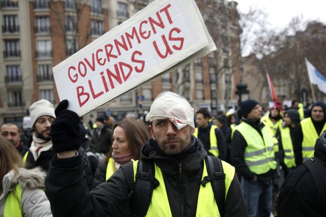 Pariz: Demonstrant ranjen policijskim projektilom u oko, unutrašnja istraga u toku VIDEO