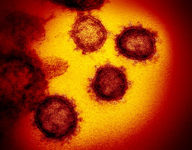 Da li epidemija koronavirusom može prerasti u pandemiju? Ministar: Postoji verovatan rizik