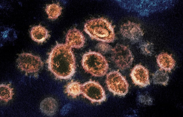 Mediji: Pet dokaza da virus nije isti. 