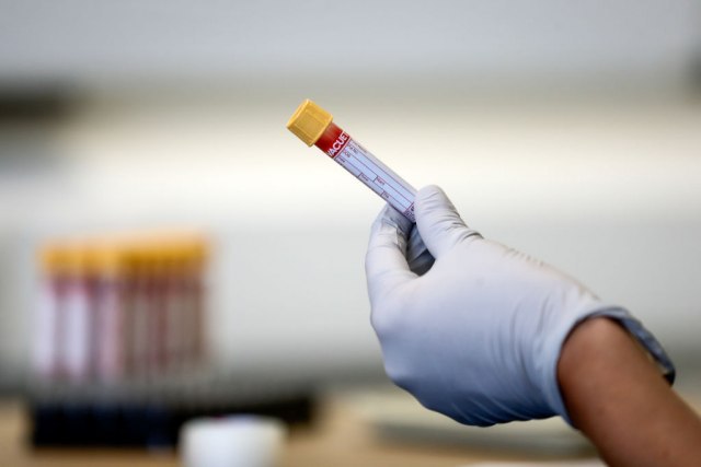 426 people in Serbia tested positive for coronavirus, and eight died