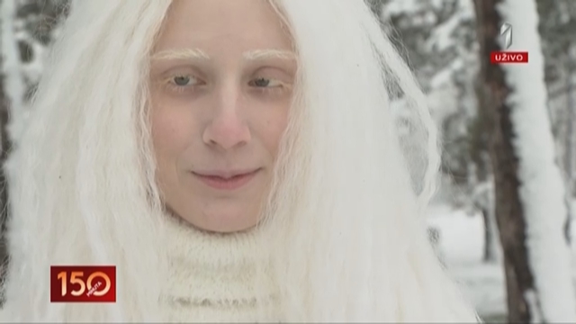 Devojka iz bajke: Sumi je rođena sa albinizmom, bavi se modelingom, crta anime, nosi beli štap, a njena priča zaslužuje DIVLJENJE!