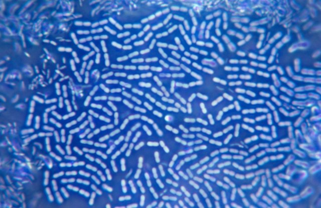Pronaðene bakterije nepoznate ljudskom imunom sistemu