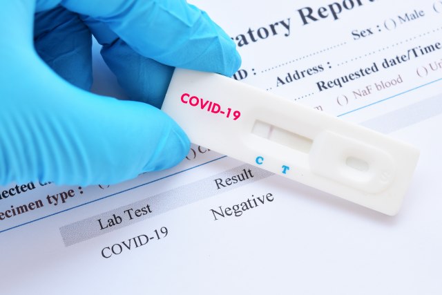 Opada broj novoobolelih od koronavirusa širom Srbije