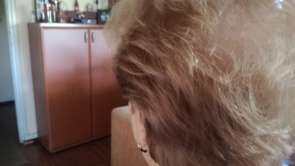 Korona virus i opadanje kose: "Samo da ne oæelavim i ne nosim periku"