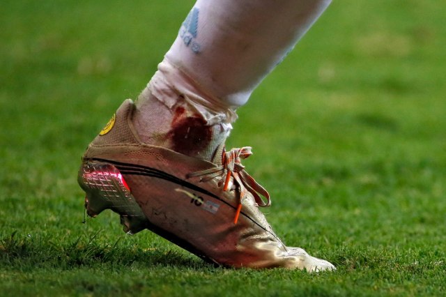 Krv, suze i znoj – Mesi daje sve za Argentinu VIDEO