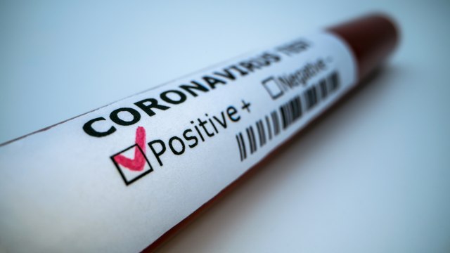 Zaraženi delta sojem korone imaju dvostruko veći rizik za hospitalizaciju - Vimarsana News
