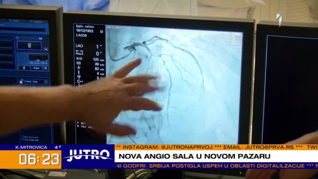 U Opštoj bolnici u Novom Pazaru počela da radi angio sala VIDEO