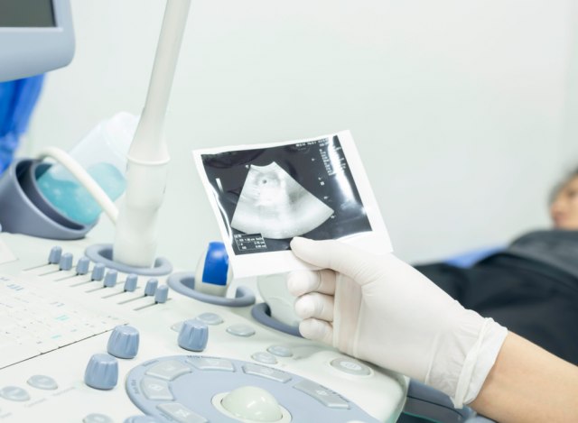 U jetri joj otkrili fetus deteta; lekar: "Ovo još nisam video"