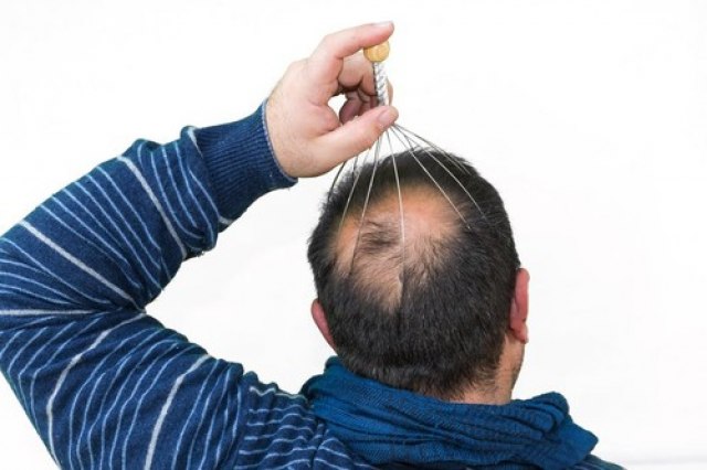 U zabludi ste ako mislite da ova sprava služi za masiranje glave! Ima potpuno drugačiju namenu...