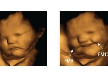 Reakcije ovog fetusa koji izgleda kao da se smeje, fotografisane su 20 minuta nakon što su majke konzumirale kapsule šargarepe u prahu/Fetal and Neonatal Research Lab, Durham University