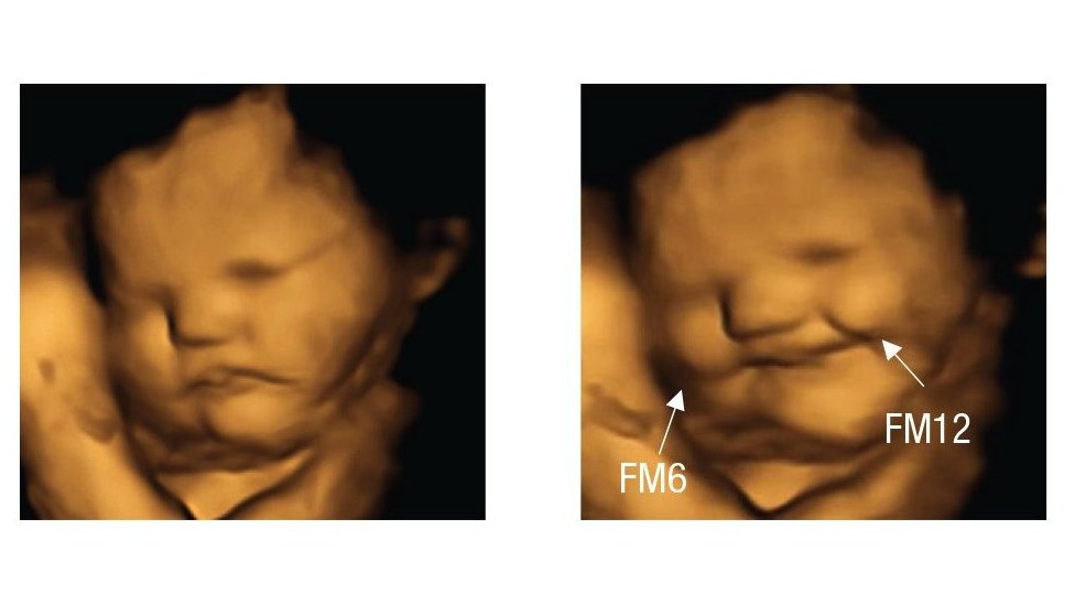 Nauka: Neroðene bebe se "smeškaju&#x201d; šargarepi i "mršte&#x201d; kelju, pokazalo je istraživanje