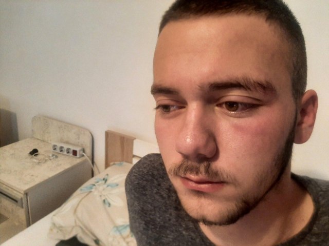 Novi napad Albanaca: Srpski mladiæ pretuèen na KiM; "Do sedam jutros su ga držali u stanici"  FOTO