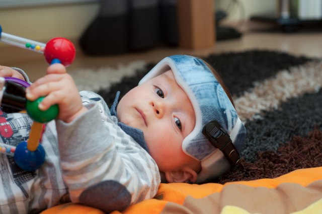 Roditelji pokrenuli bizaran trend, teraju decu da nose kacige kako bi im oblikovali glave