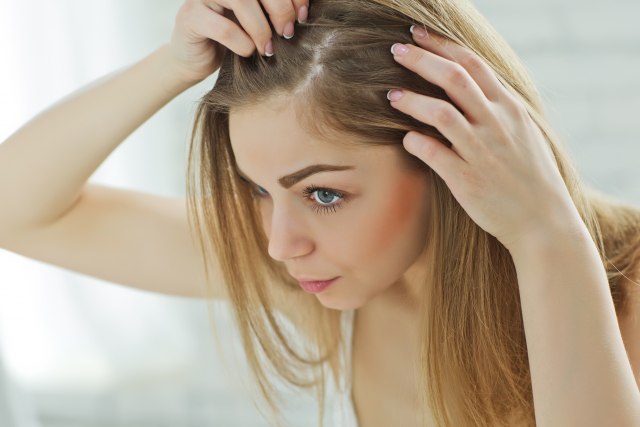 Ako vam je kosa često masna, promenite način pranja: Deluje neobično, ali ova metoda je ključna