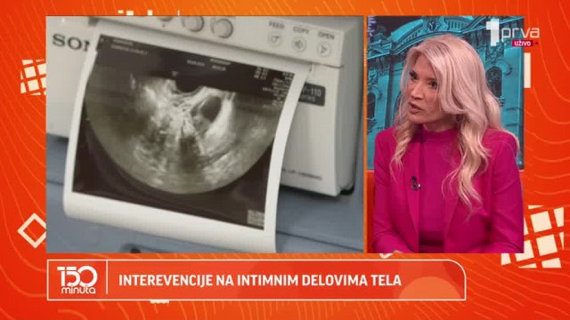 Estetska ginekologija: Metode za bolji seksualni užitak - kada se rade i da li su riziène VIDEO