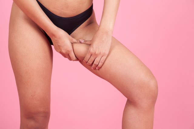 Pripremite sami ANTICELULIT ulje - važi za najefikasnije...