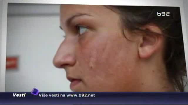 Funkcioner „Vojvodine“ udario sportistkinju „Zvezde“
