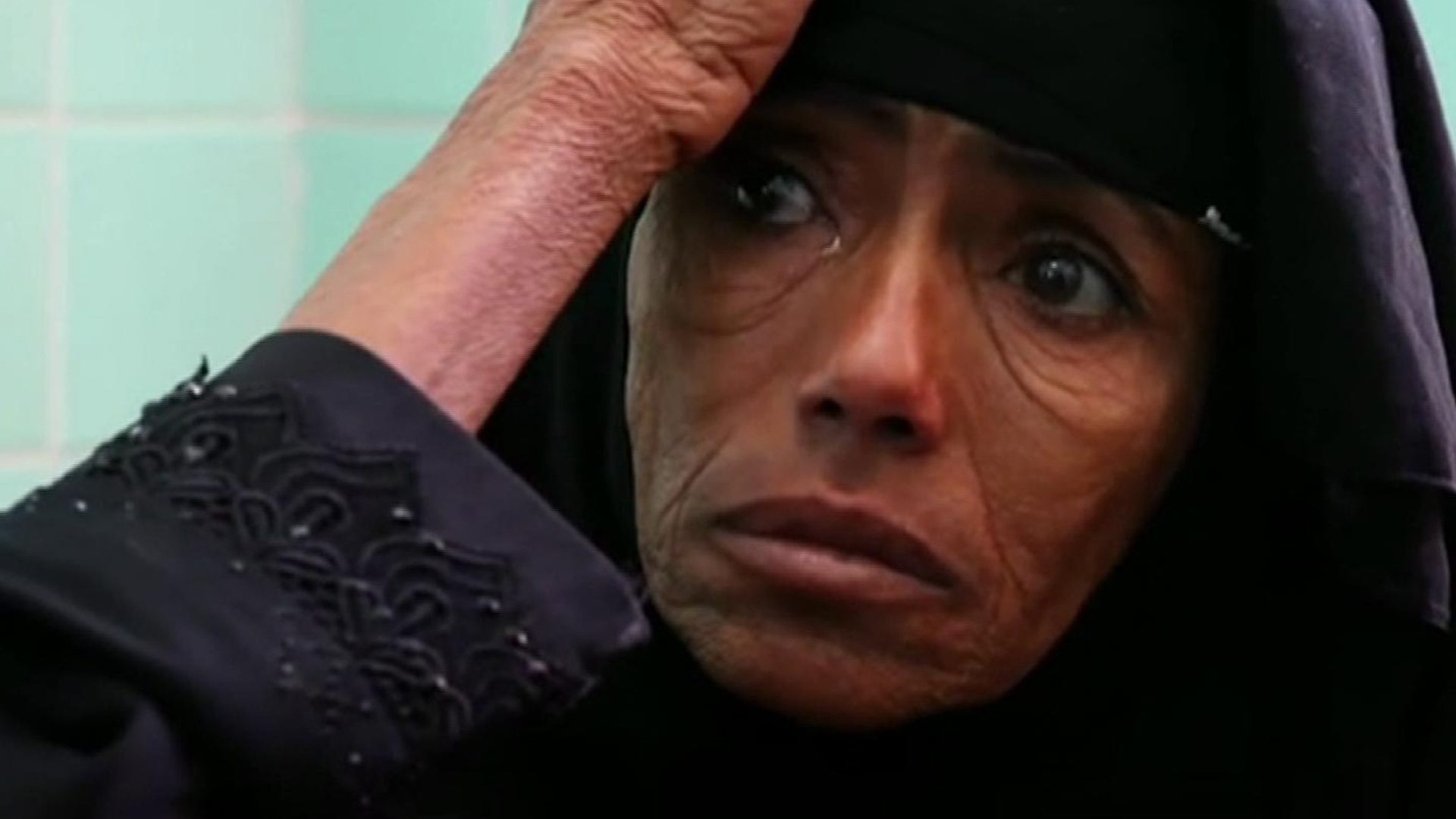 Yemen on brink of 'worst famine in 100 years'