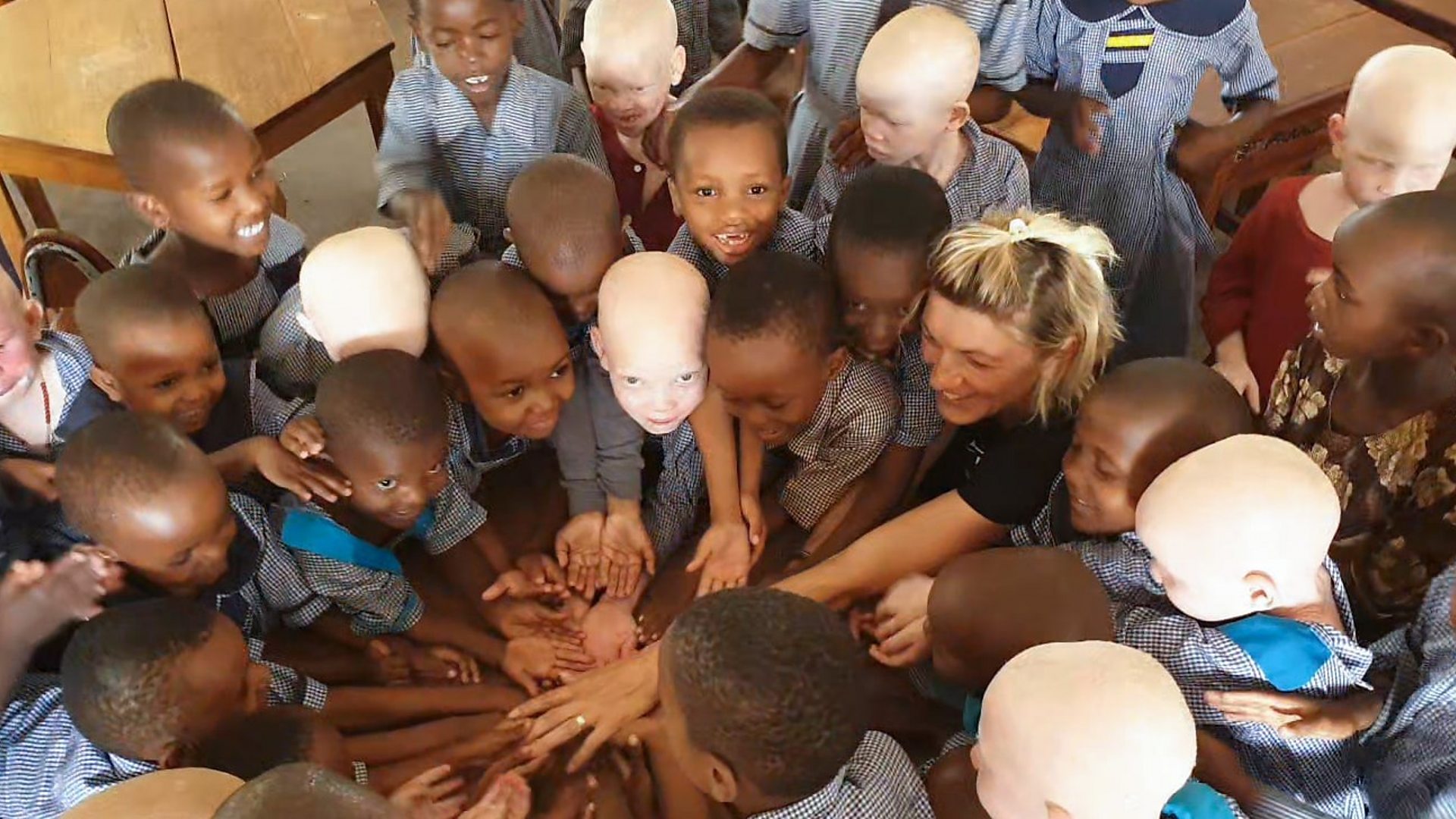Мартина спашава децу са албинизмом: 