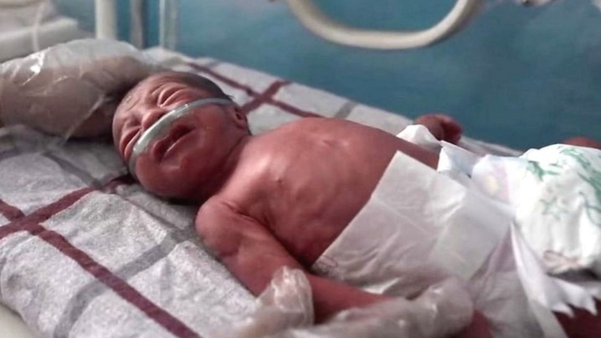 Борба новорођенчади за живот у АвганистаC
